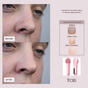 FRAIS 2 in 1 Heating Ultrasonic Vibration  Facial Brush