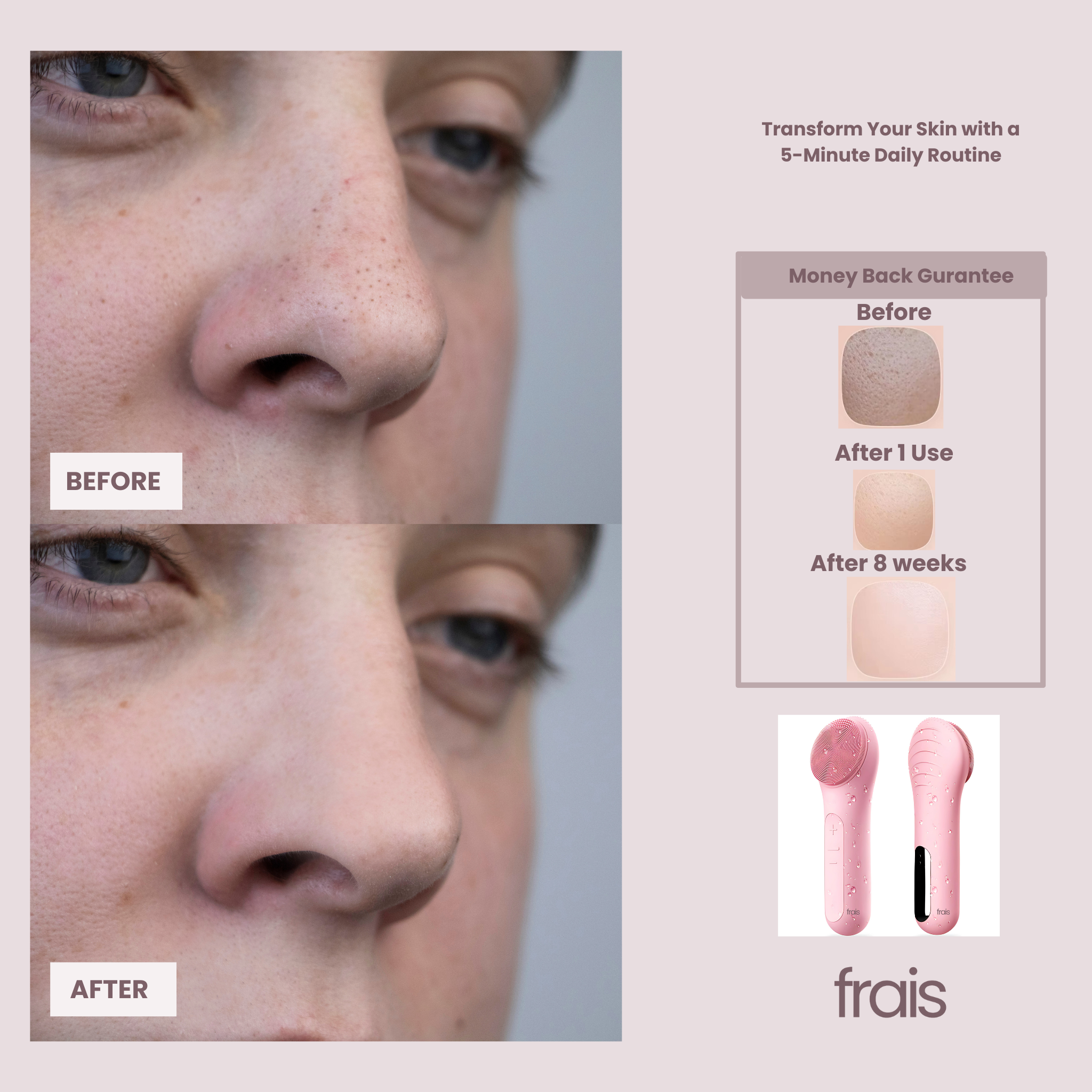 FRAIS 2 in 1 Heating Ultrasonic Vibration  Facial Brush