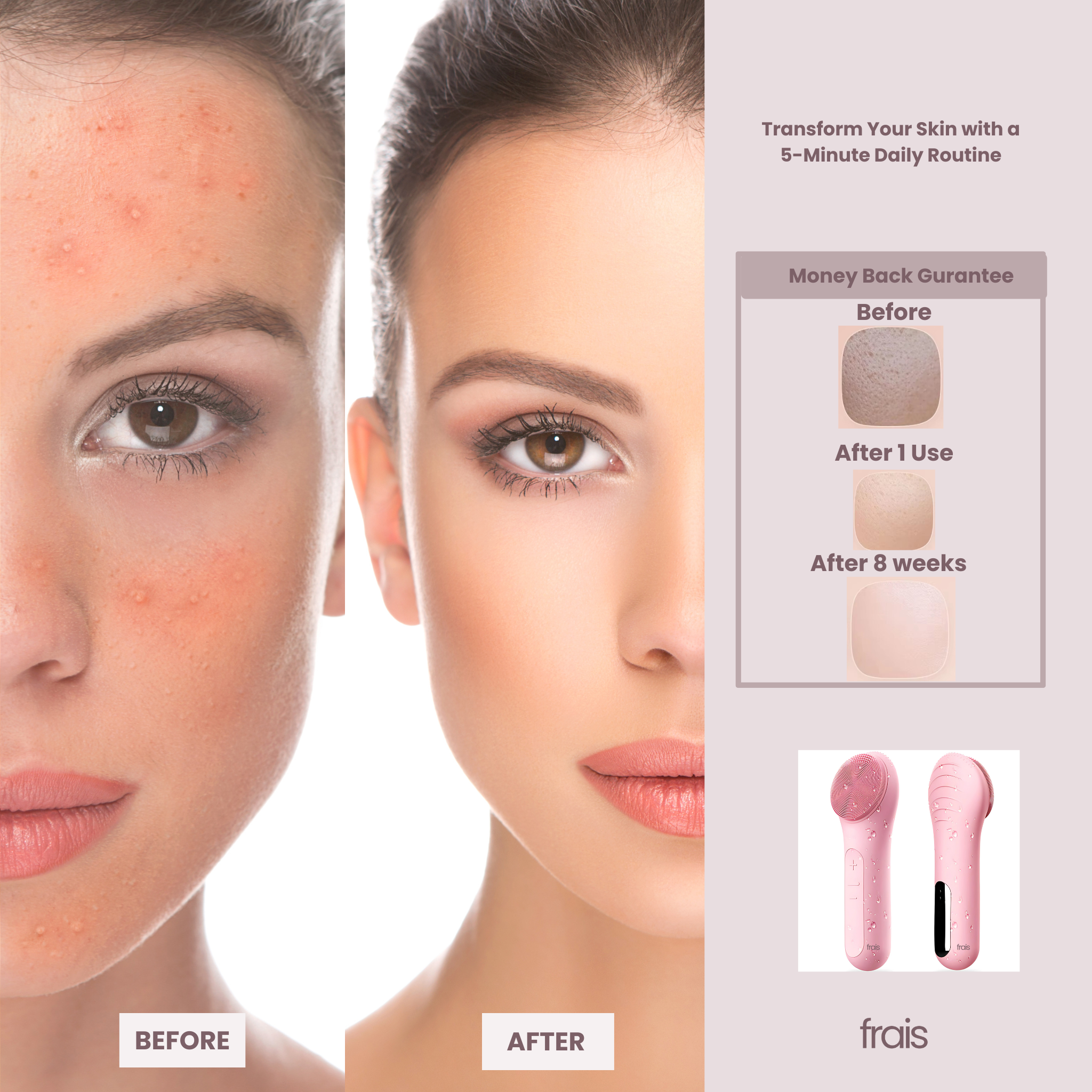 FRAIS 2 in 1 Heating Ultrasonic Vibration  Facial Brush