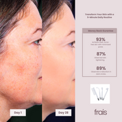 FRAIS Portable High Frequency Wand