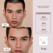 FRAIS Portable High Frequency Wand