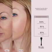 FRAIS Microdermabrasion Facial Rolle