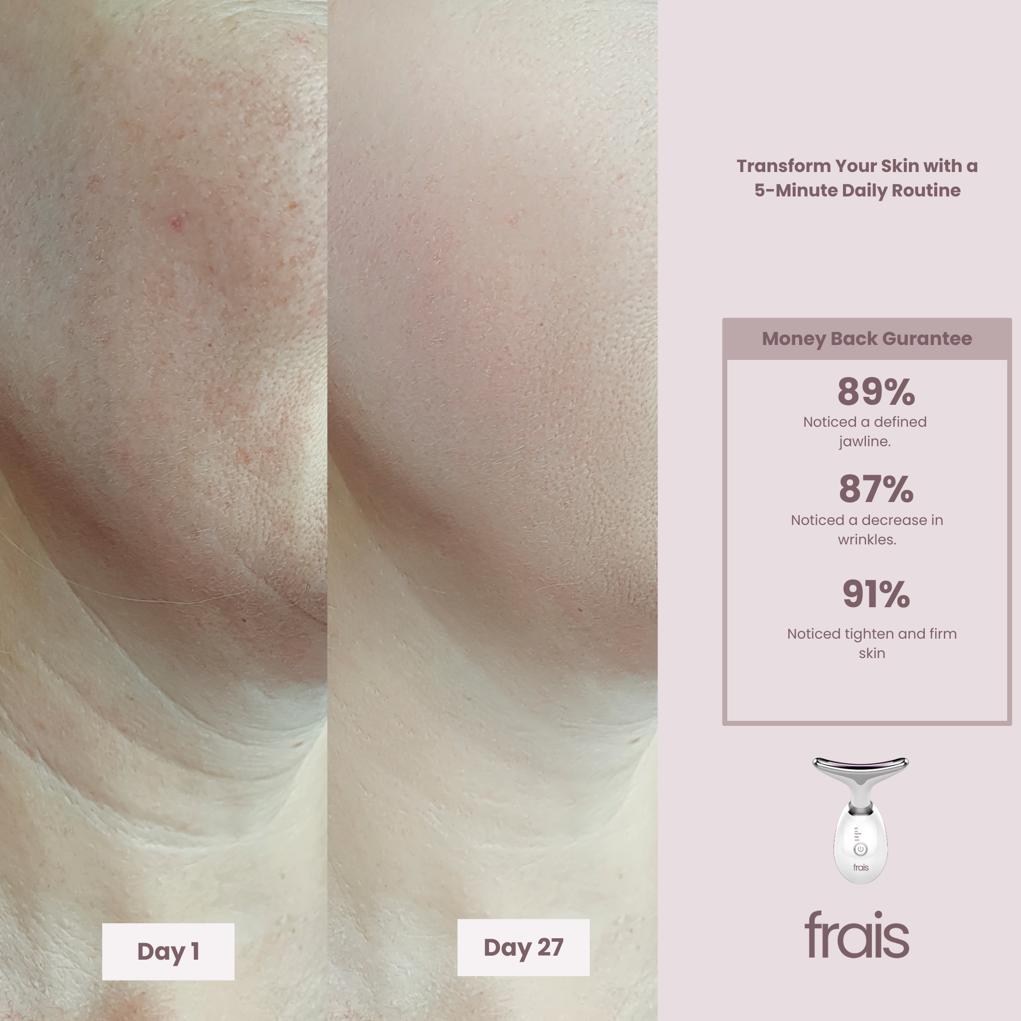 FRAIS 7 Color LED Facial Light Therapy Wand for Skin Care at Home