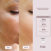 FRAIS 7 Color LED Facial Light Therapy Wand for Skin Care at Home