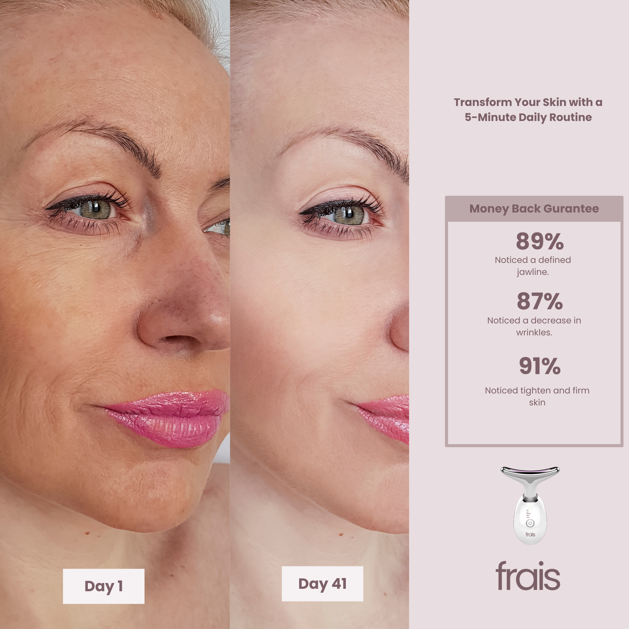 FRAIS 7 Color LED Facial Light Therapy Wand for Skin Care at Home
