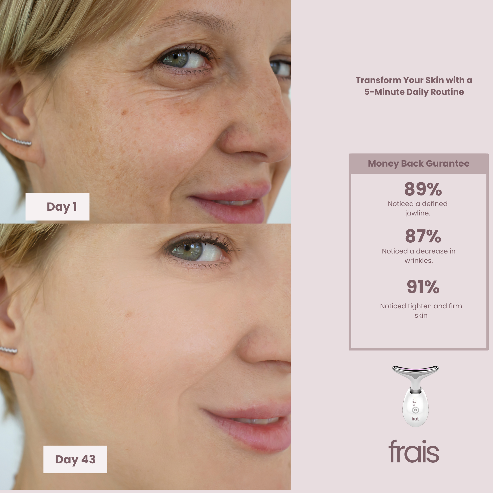 FRAIS 7 Color LED Facial Light Therapy Wand for Skin Care at Home