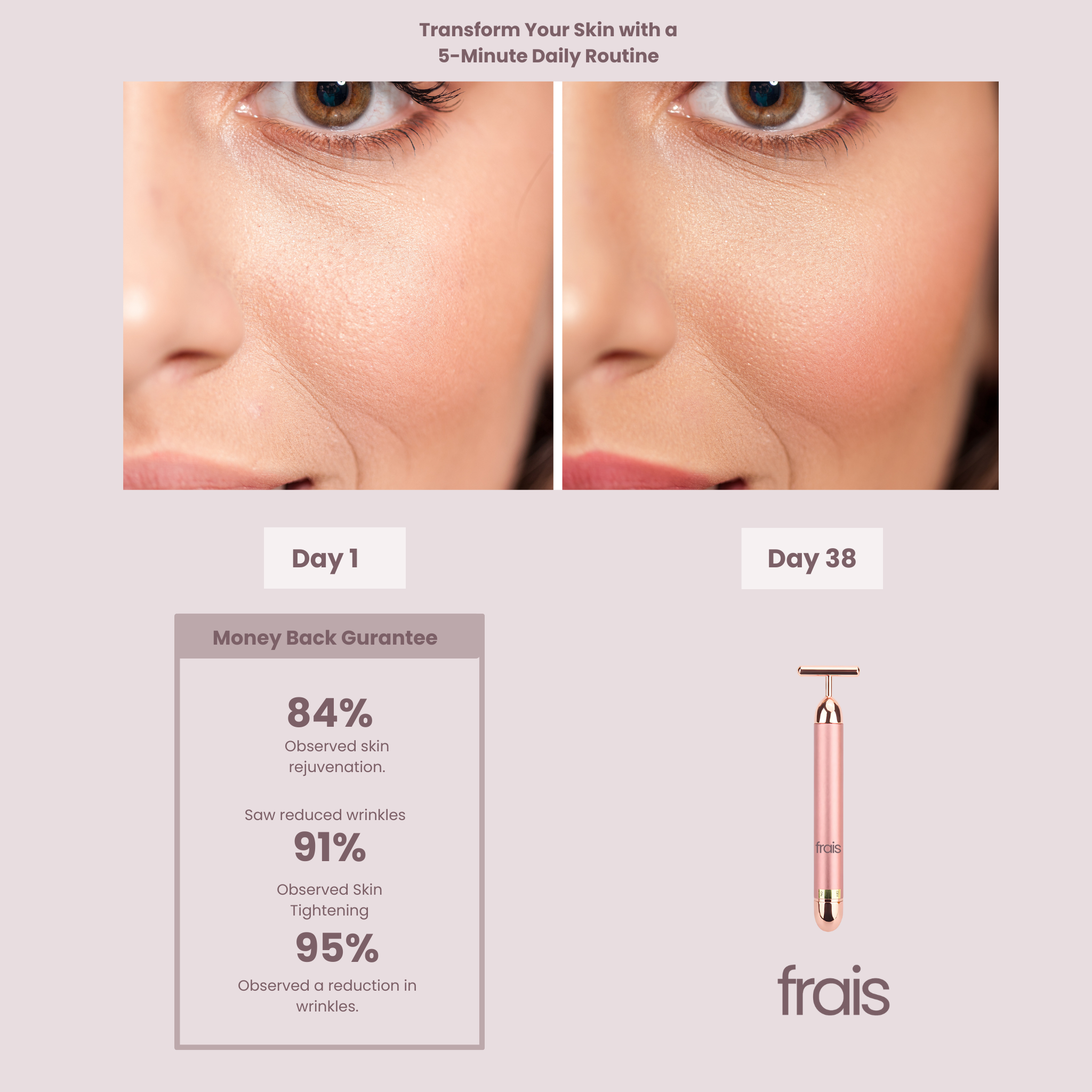 FRAIS Pulse Facial Massager,Vibrating T Bar