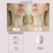FRAIS LED Face Mask Light Therapy