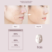 FRAIS LED Face Mask Light Therapy