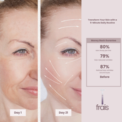 Frais Facial wand 2
